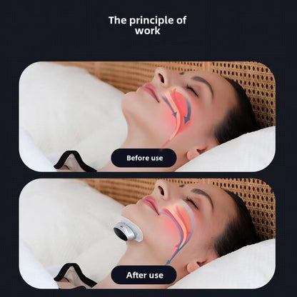 New AI Smart Anti Snoring Device – Dual Pulse Snore Stopper & Breathing Aid WIth 10 Stickers